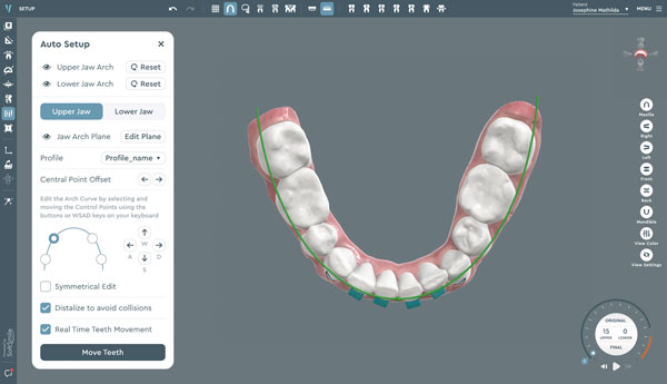 ai-in-orthodontics