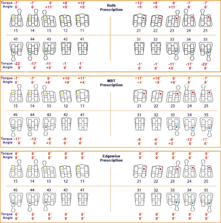 roth mbt edgewise